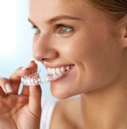 Adult Cosmetic Braces - Gloucester Street Dental