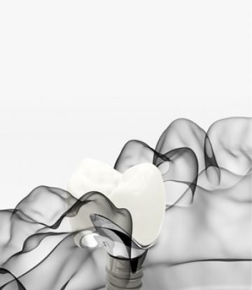 Treatment - Gloucesterstreetdental